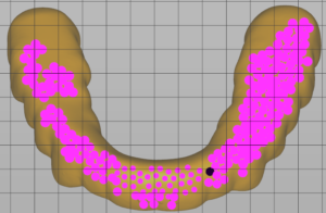 Brown Splint Model Angled at 90 Degrees with Purple Supports