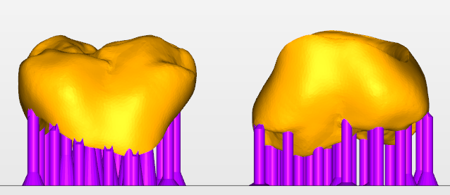 Yellow Molar Models with Best Mechanical Properties with Purple Supports