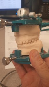 Hanau™ Model Mate Dental Articulator with Mounted Model